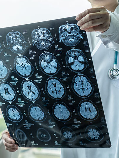 Brain disease diagnosis with medical doctor 